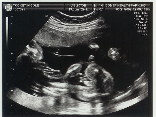 Click Here